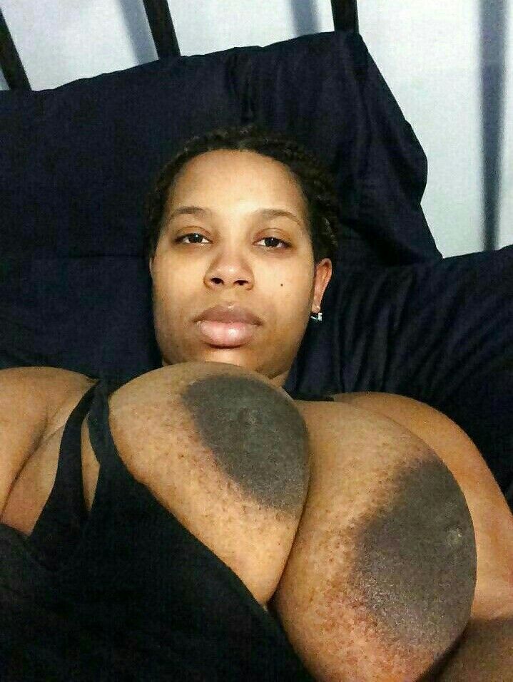 boo peterson recommends giant black areolas pic